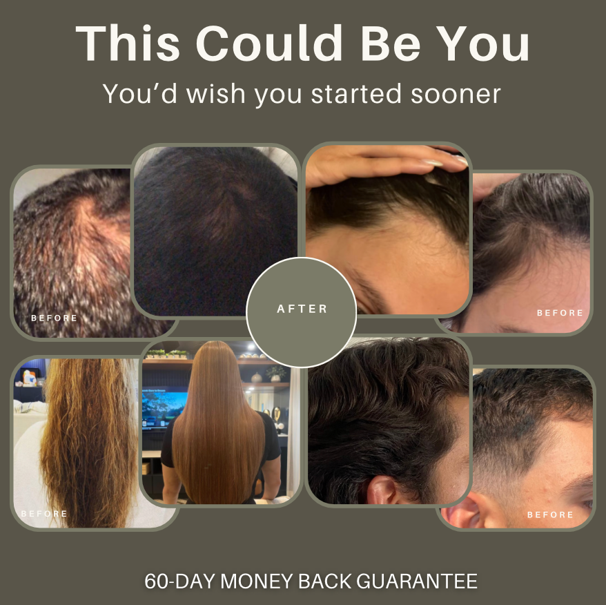 Before and after hair transformation images with text 'This Could Be You' and '60-Day Money Back Guarantee'.